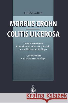 Morbus Crohn - Colitis Ulcerosa Guido Adler M. Von Starlinger 9783642646614 Springer - książka