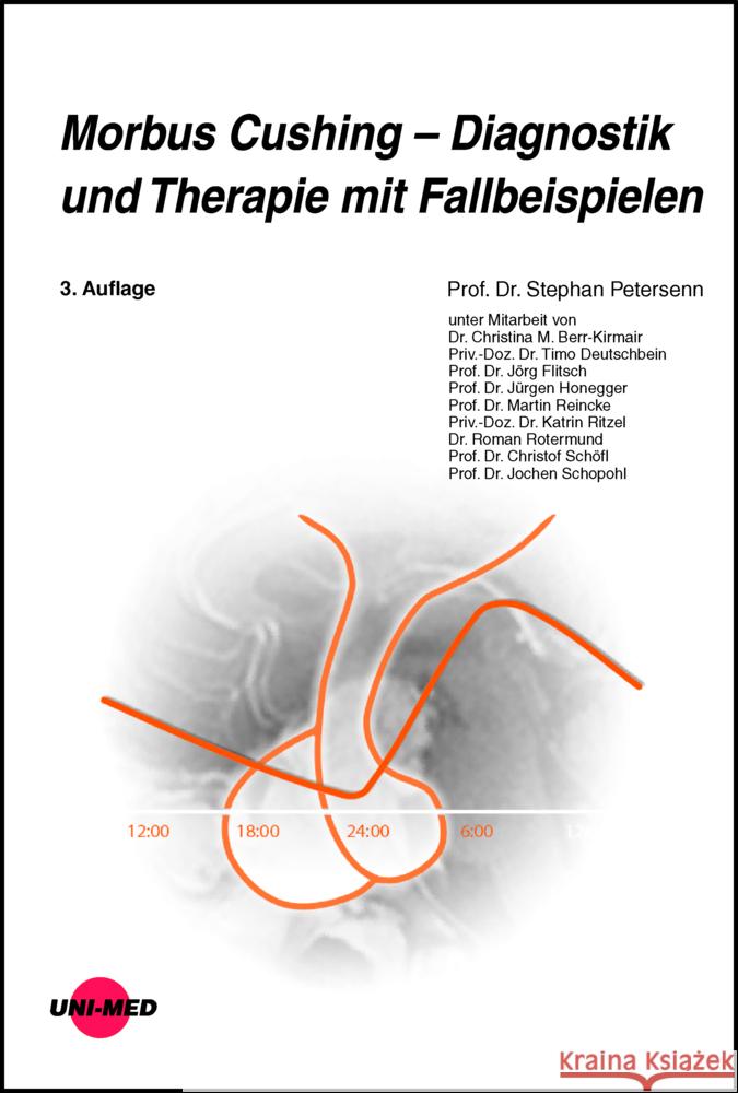 Morbus Cushing - Diagnostik und Therapie mit Fallbeispielen Petersenn, Stephan 9783837424508 UNI-MED, Bremen - książka