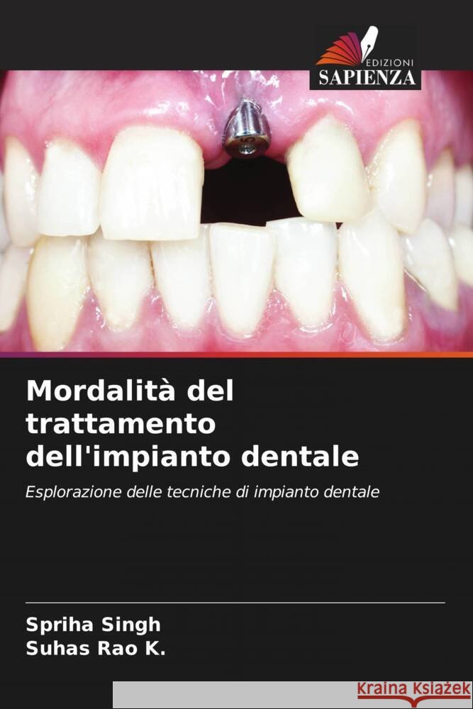 Mordalit? del trattamento dell'impianto dentale Spriha Singh Suhas Rao K 9786208069377 Edizioni Sapienza - książka