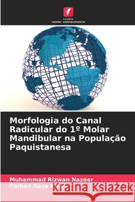 Morfologia do Canal Radicular do 1? Molar Mandibular na Popula??o Paquistanesa Muhammad Rizwan Nazeer Farhan Raza Khan 9786207874002 Edicoes Nosso Conhecimento - książka