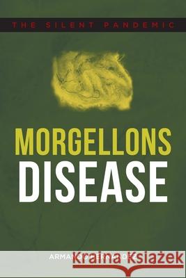 Morgellons Disease: The Silent Pandemic Armando Hernandez 9781648010248 Newman Springs Publishing, Inc. - książka