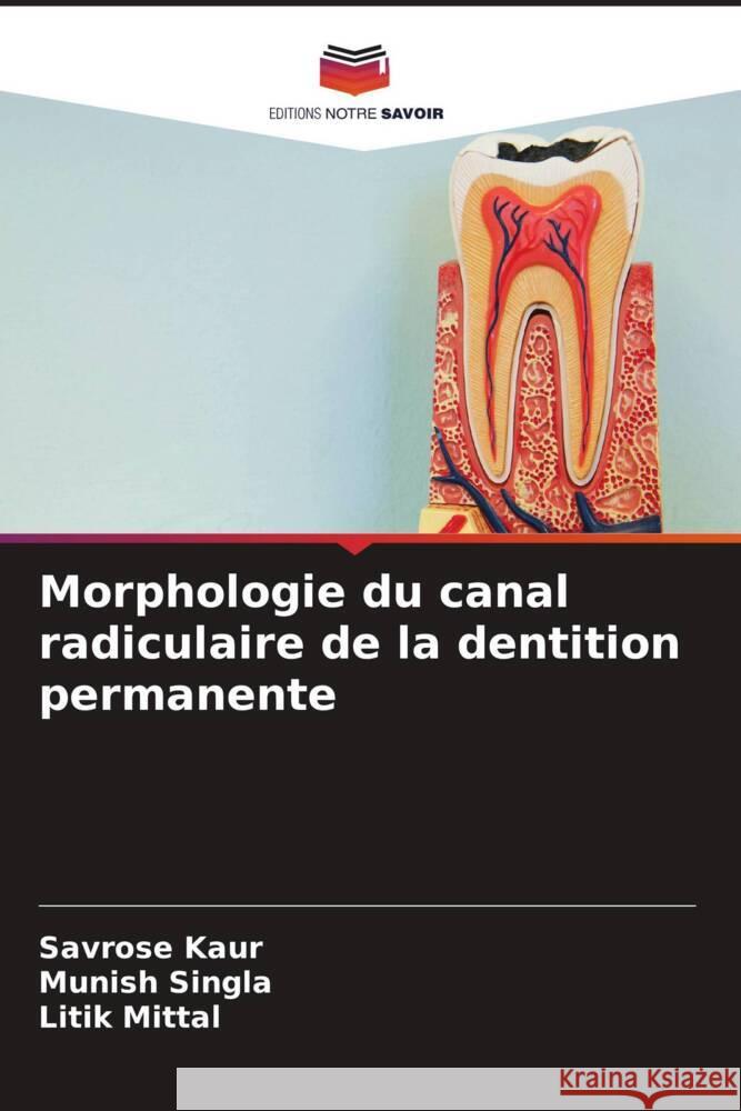 Morphologie du canal radiculaire de la dentition permanente Kaur, Savrose, Singla, Munish, Mittal, Litik 9786204823065 Editions Notre Savoir - książka