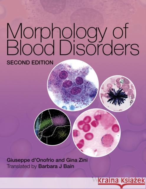 Morphology of Blood Disorders d′Onofrio, Giuseppe; Zini, Gina 9781118442609 John Wiley & Sons - książka