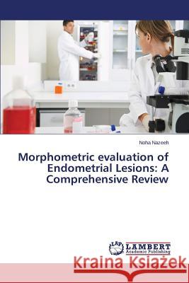 Morphometric evaluation of Endometrial Lesions: A Comprehensive Review Nazeeh Noha 9783659463853 LAP Lambert Academic Publishing - książka