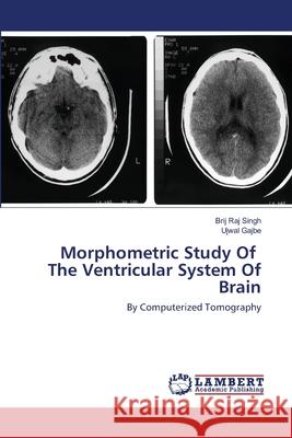 Morphometric Study Of The Ventricular System Of Brain Brij Raj Singh, Ujwal Gajbe 9786202518109 LAP Lambert Academic Publishing - książka