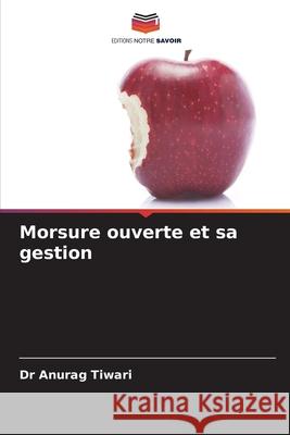 Morsure ouverte et sa gestion Dr Anurag Tiwari 9786204173672 Editions Notre Savoir - książka