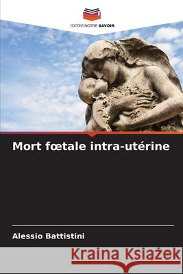 Mort foetale intra-utérine Battistini, Alessio 9786209162190 Editions Notre Savoir - książka