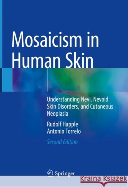 Mosaicism in Human Skin: Understanding Nevi, Nevoid Skin Disorders, and Cutaneous Neoplasia Rudolf Happle Antonio Torrelo 9783030899363 Springer - książka