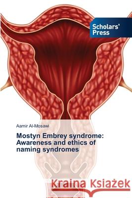 Mostyn Embrey syndrome: Awareness and ethics of naming syndromes Aamir Al-Mosawi 9783659837227 Scholars' Press - książka