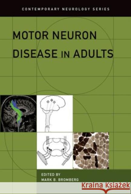 Motor Neuron Disease in Adults Mark Bromberg 9780199783113 Oxford University Press, USA - książka