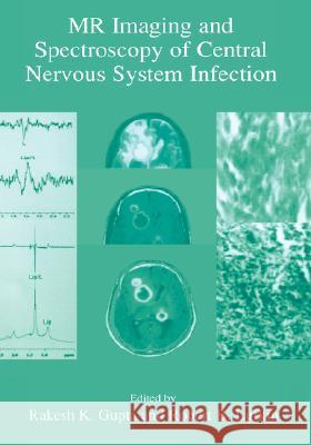MR Imaging and Spectroscopy of Central Nervous System Infection Robert B. Lufkin Rakesh K. Gupta Rakesh K. Gupta 9780306465512 Kluwer Academic Publishers - książka