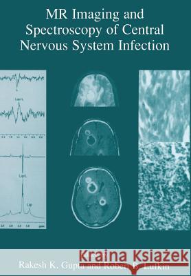 MR Imaging and Spectroscopy of Central Nervous System Infection Rakesh K. Gupta Robert B. Lufkin 9781475705737 Springer - książka