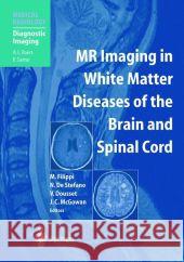MR Imaging in White Matter Diseases of the Brain and Spinal Cord K. Sartor 9783642072987 Not Avail - książka