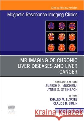 MR Imaging of Chronic Liver Diseases and Liver Cancer, an Issue of Magnetic Resonance Imaging Clinics of North America, 29 Khaled M. Elsayes Claude Sirlin 9780323776134 Elsevier - książka