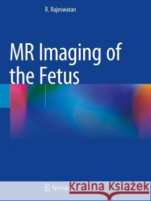 MR Imaging of the Fetus R. Rajeswaran 9789811692116 Springer Nature Singapore - książka