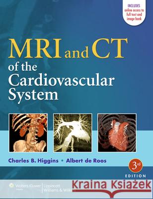 MRI and CT of the Cardiovascular System Higgins 9781451137316 Lippincott Williams & Wilkins - książka