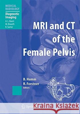 MRI and CT of the Female Pelvis A.L: Baert, Bernd Hamm, Rosemarie Forstner 9783642060892 Springer-Verlag Berlin and Heidelberg GmbH &  - książka