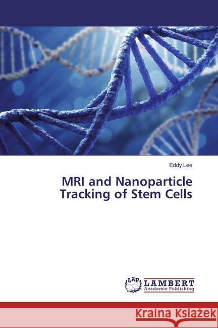 MRI and Nanoparticle Tracking of Stem Cells Lee, Eddy 9786139925254 LAP Lambert Academic Publishing - książka