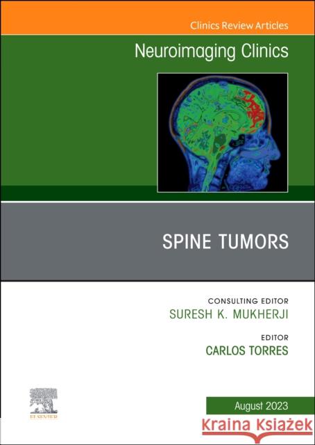 MRI and Traumatic Brain Injury, An Issue of Neuroimaging Clinics of North America  9780323972864 Elsevier - Health Sciences Division - książka