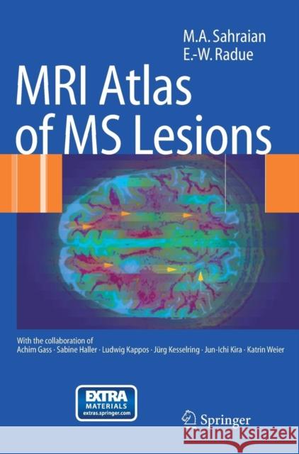 mri atlas of ms lesions  Gass, A. 9783540713715 SPRINGER-VERLAG BERLIN AND HEIDELBERG GMBH &  - książka