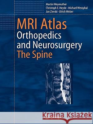 MRI Atlas: Orthopedics and Neurosurgery, the Spine Herwig, B. 9783642070150 Not Avail - książka