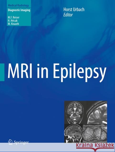 MRI in Epilepsy Horst Urbach 9783642251375 Springer - książka