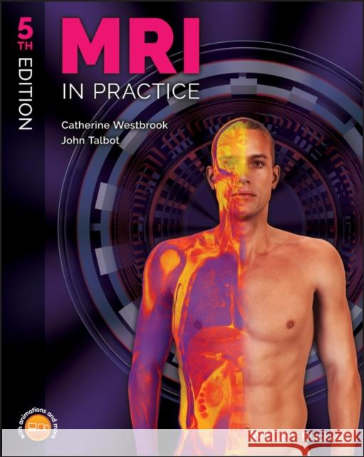 MRI in Practice Catherine Westbrook John Talbot 9781119391968 John Wiley and Sons Ltd - książka