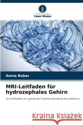 MRI-Leitfaden für hydrozephales Gehirn Amna Babar 9786204159393 Verlag Unser Wissen - książka