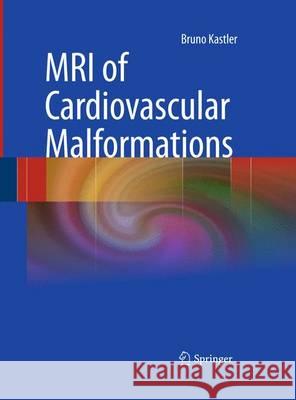 MRI of Cardiovascular Malformations Bruno Kastler 9783642438387 Springer - książka