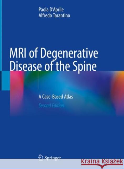 MRI of Degenerative Disease of the Spine: A Case-Based Atlas Paola D'Aprile Alfredo Tarantino 9783030737061 Springer - książka