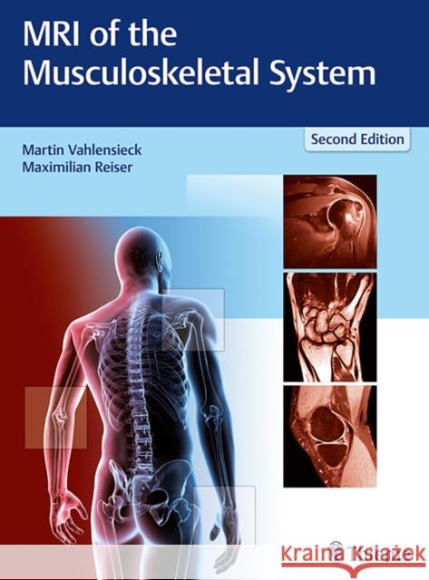 MRI of the Musculoskeletal System Martin Vahlensieck Maximilian Reiser 9783131165725 Thieme Medical Publishers - książka