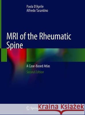 MRI of the Rheumatic Spine: A Case-Based Atlas D'Aprile, Paola 9783030329952 Springer - książka