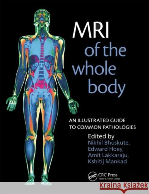 MRI of the Whole Body: An Illustrated Guide for Common Pathologies Bhuskute, Nikhil 9781853157769  - książka