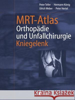 Mrt-Atlas Orthopädie Und Unfallchirurgie: Kniegelenk Teller, Peter 9783642626548 Springer - książka