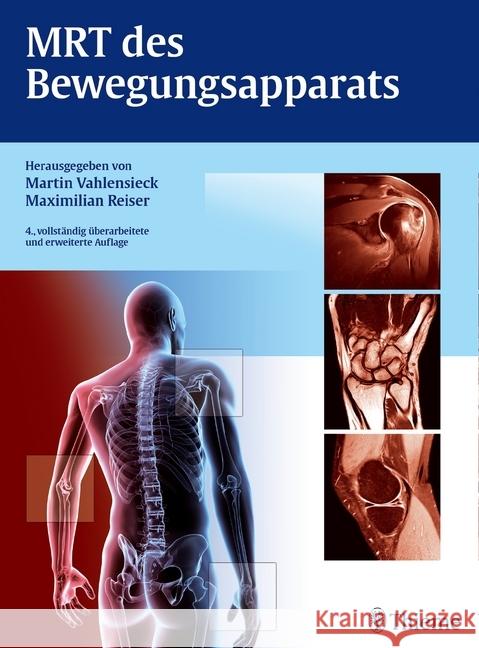 MRT des Bewegungsapparats Vahlensieck, Martin; Reiser, Maximilian 9783131036841 Thieme, Stuttgart - książka