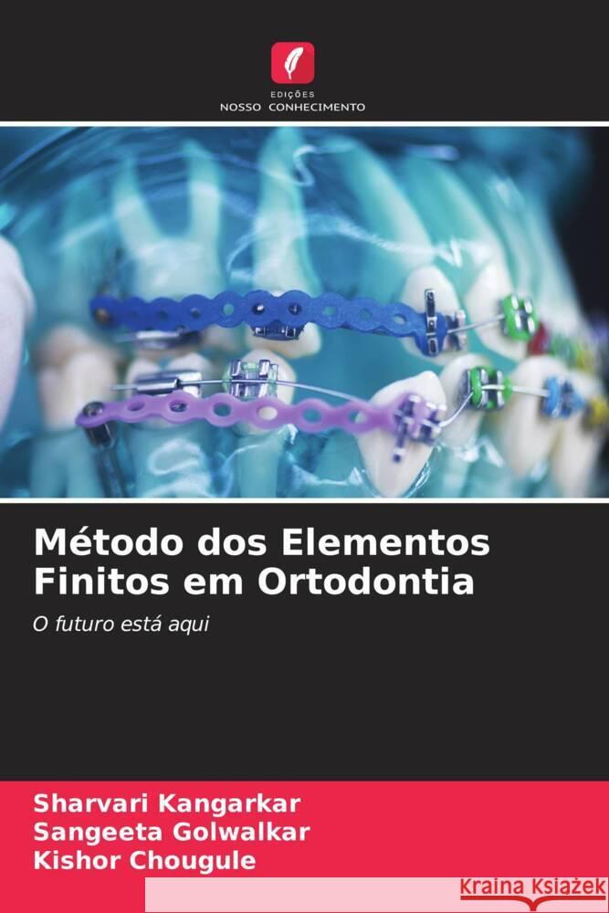 Método dos Elementos Finitos em Ortodontia Kangarkar, Sharvari, Golwalkar, Sangeeta, Chougule, Kishor 9786205052792 Edições Nosso Conhecimento - książka