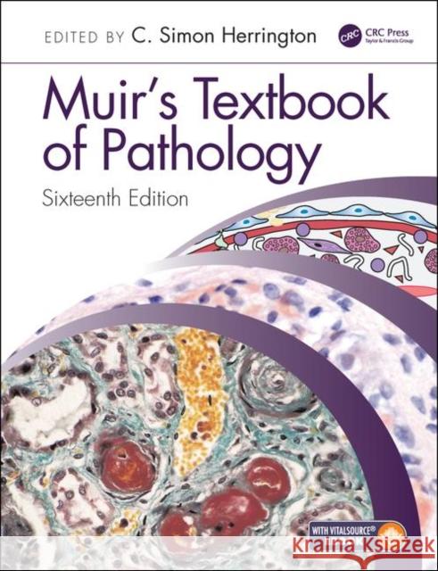 Muir's Textbook of Pathology: Sixteenth Edition International Student Edition Herrington, C. Simon 9780367146719 Taylor & Francis Ltd - książka