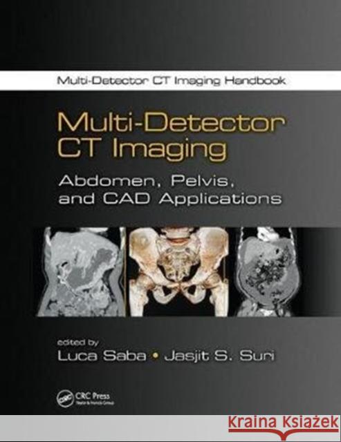 Multi-Detector CT Imaging: Abdomen, Pelvis, and CAD Applications  9781138072527  - książka