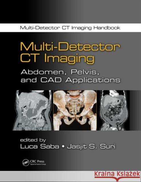 Multi-Detector CT Imaging: Abdomen, Pelvis, and CAD Applications Saba, Luca 9781439893975 CRC Press - książka