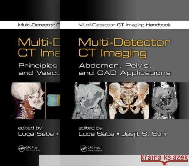 Multi-Detector CT Imaging Handbook, Two Volume Set Luca Saba Jasjit S. Suri 9781439893999 CRC Press - książka