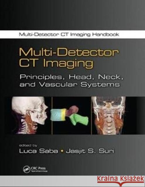 Multi-Detector CT Imaging: Principles, Head, Neck, and Vascular Systems  9781138076488  - książka