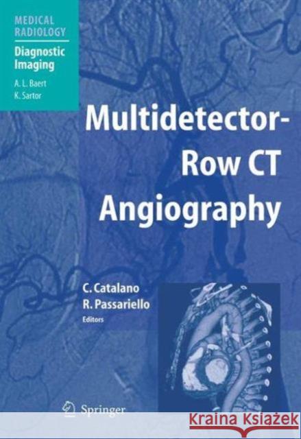 Multidetector-Row CT Angiography A. L. Baert 9783642072765 Not Avail - książka