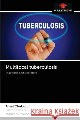 Multifocal tuberculosis Amal Chakroun, Fatma Smaoui, Makram Koubaa 9786203126044 Our Knowledge Publishing - książka