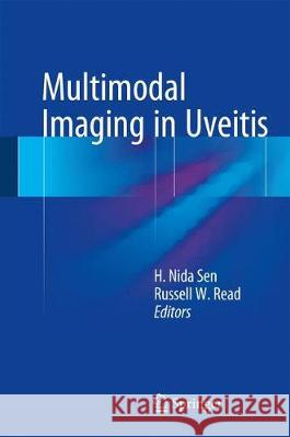 Multimodal Imaging in Uveitis H. Nida Sen Russell W. Read 9783319236896 Springer - książka