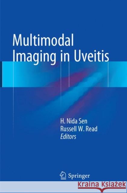 Multimodal Imaging in Uveitis H. Nida Sen Russell W. Read 9783319795232 Springer - książka