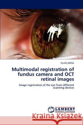 Multimodal registration of fundus camera and OCT retinal images Běťák, Ondřej 9783659228773 LAP Lambert Academic Publishing - książka