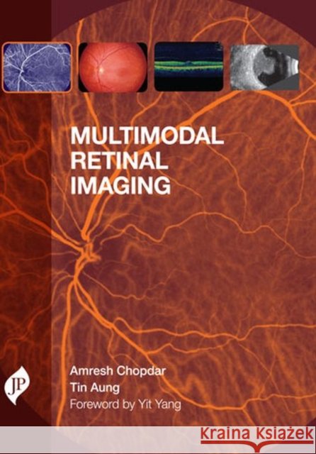 Multimodal Retinal Imaging Amresh Chopdar Tin Aung  9781907816604 JP Medical Ltd - książka
