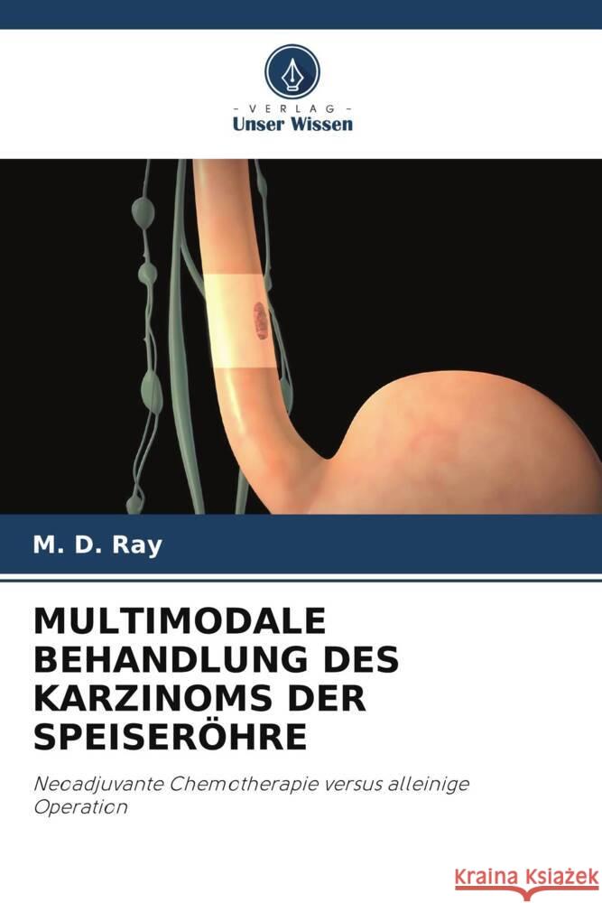 MULTIMODALE BEHANDLUNG DES KARZINOMS DER SPEISERÖHRE Ray, M. D. 9786204889658 Verlag Unser Wissen - książka