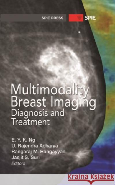 Multimodality Breast Imaging : Diagnosis and Treatment E Y K Ng & Rajendra Acharya 9780819492944  - książka