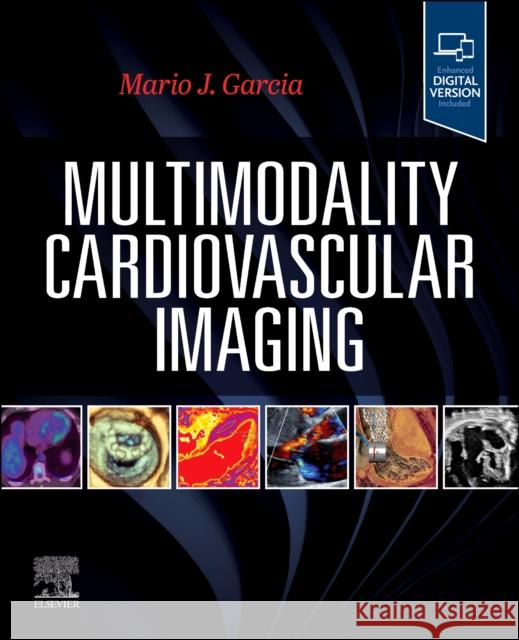 Multimodality Cardiovascular Imaging Mario J. Garcia 9780443115141 Elsevier Health Sciences - książka